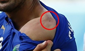 Giorgio Chiellini Shows Suarez Bite Mark